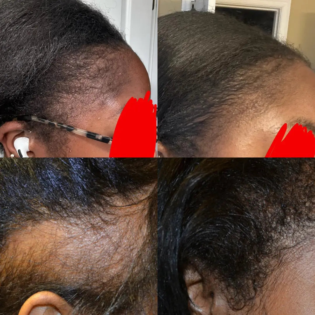 HUILE DE CROISSANCE AU BATANA