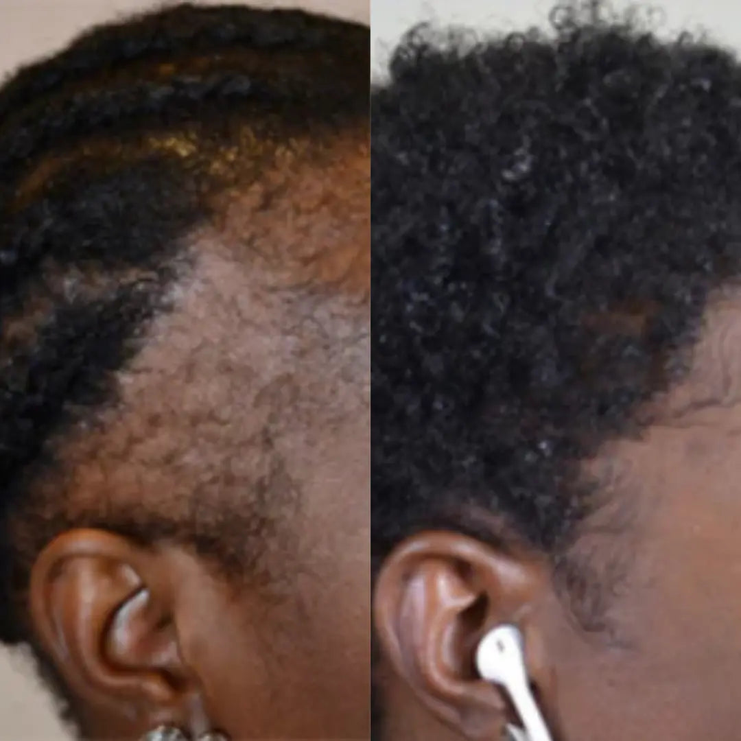 HUILE DE CROISSANCE AU BATANA