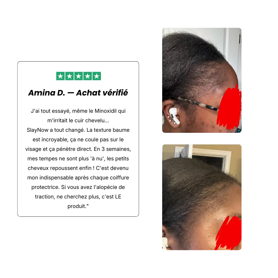 HUILE DE CROISSANCE AU BATANA