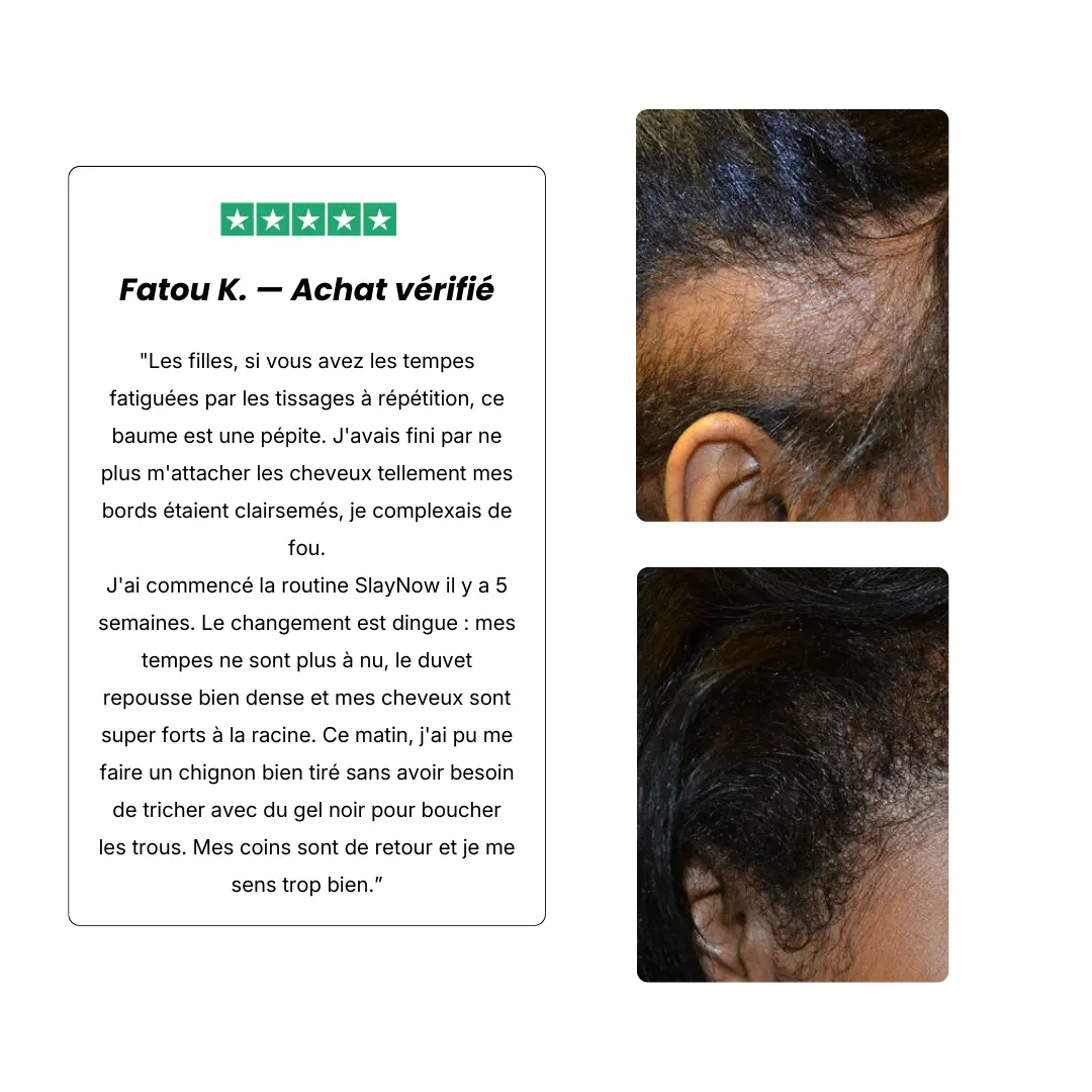 HUILE DE CROISSANCE AU BATANA